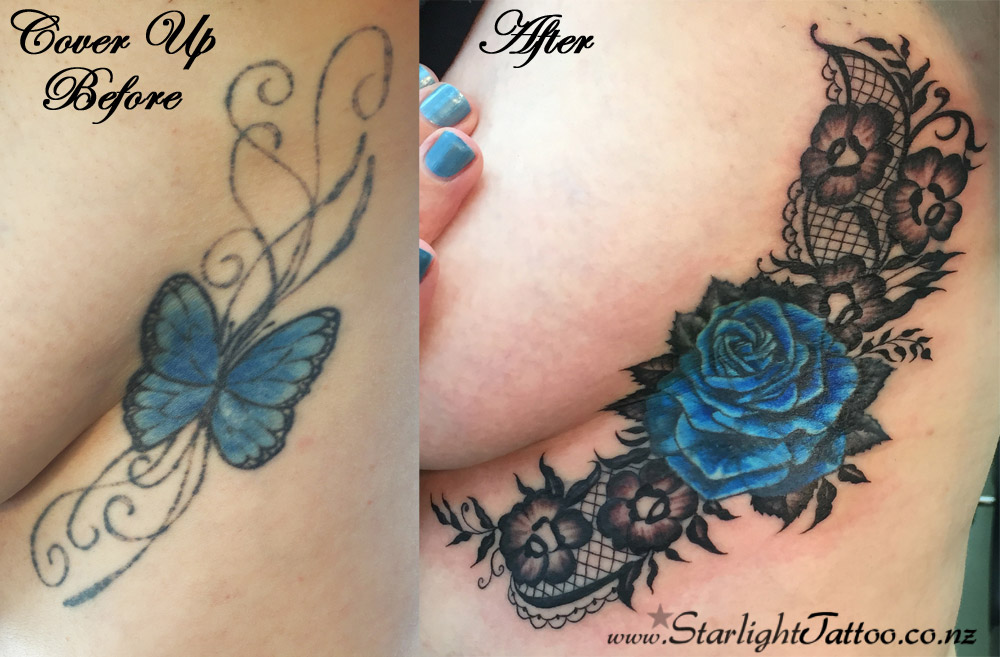 Lace-tattoo-cover-up-with-intricate-ornamental-patterns