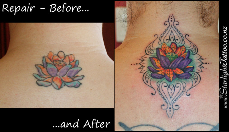 Lotus-tattoo-repair-symbolizing-renewal-and-serenity
