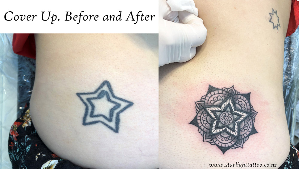 Mandala-cover-up-tattoo-with-balanced-symmetry-and-sacred-geometry