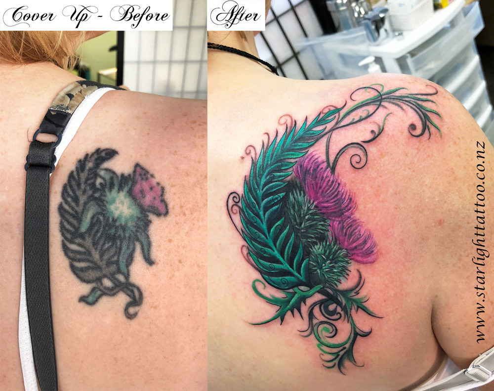 Thistle-cover-up-tattoo-representing-resilience-and-protection